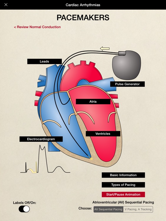 HeartCharts screenshot-3