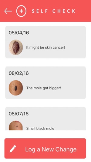 SelfCheck - Skin Cancer Prevention(圖4)-速報App