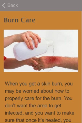 How To Treat Burns screenshot 3
