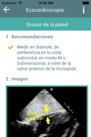 Ecocardioscopia screenshot 3