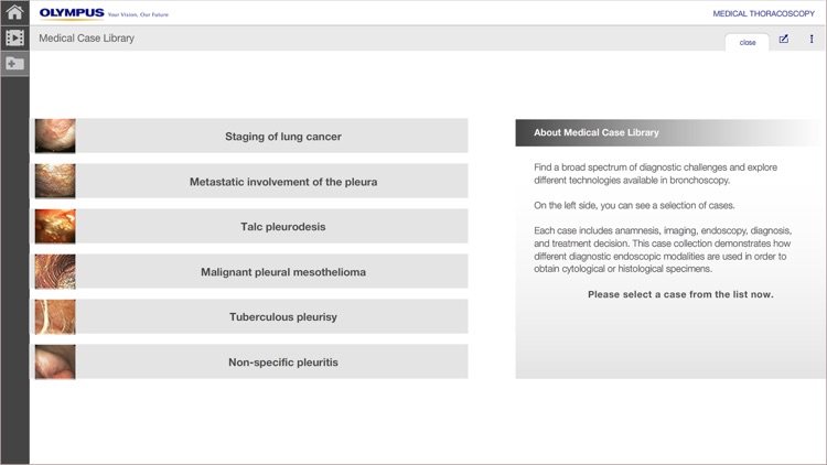 MedThora - Medical Thoracoscopy Under Local Anaesthesia screenshot-3