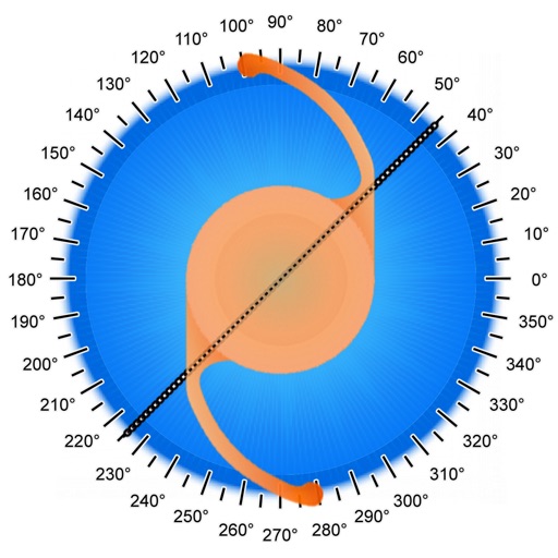 Toric Lab - Simulations for Toric IOL