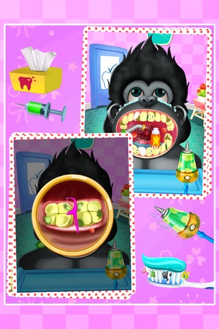 Crazy Gorilla Teeth Doctor - Doctor Game for Family screenshot 2
