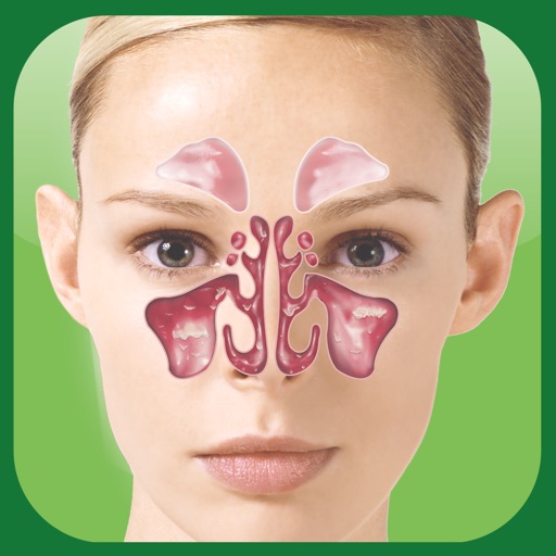 Sinus Allergy Pro™ by McNeil-PPC, Inc