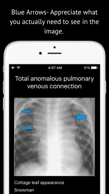 Radiology Imaging for Students