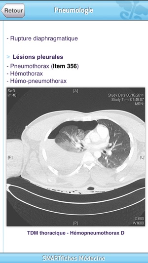 SMARTfiches Pneumologie(圖3)-速報App