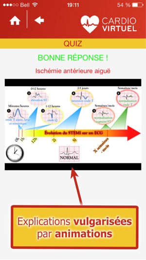 Cardio Virtuel présenté par des médecins spécialistes de l'U(圖3)-速報App