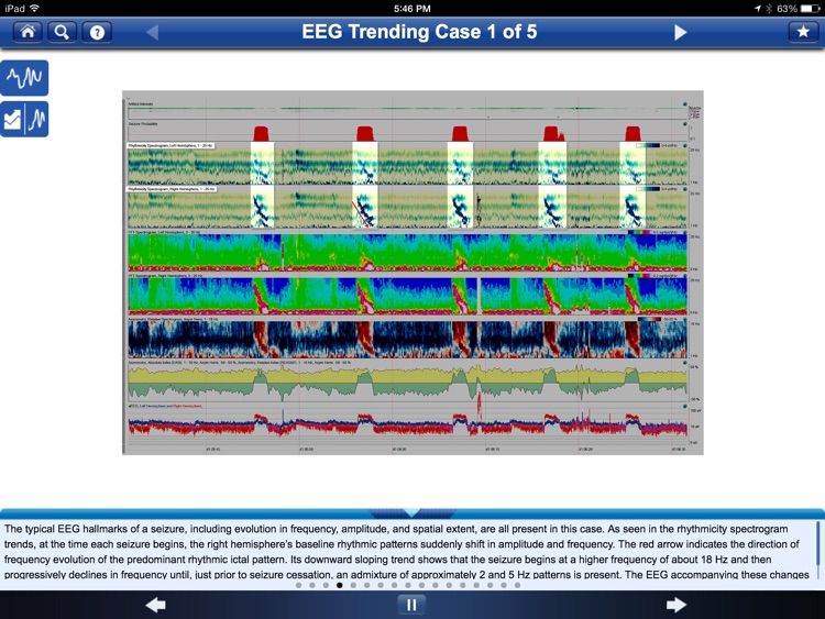 Adult EEG: An Interactive Reading Session screenshot-3