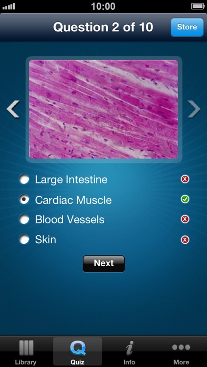 Histology - A reference guide for Pathology, Biology, Pharmacology students screenshot-3