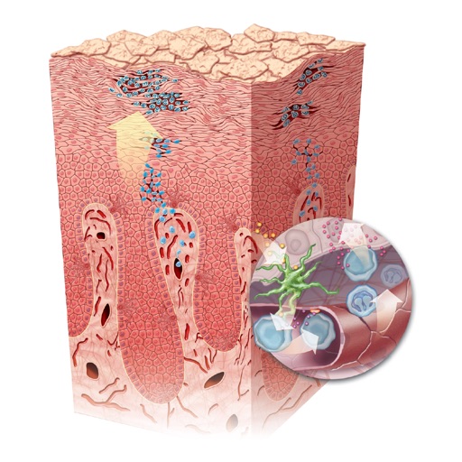 Miniatlas Psoriasis