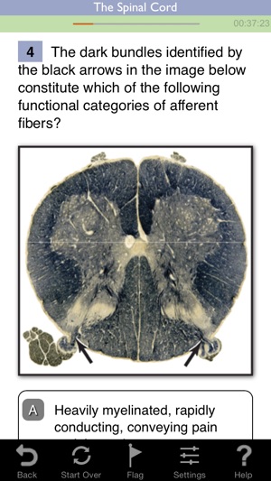 Neuroscience Lippincott's Illustrated Q&A Review(圖2)-速報App