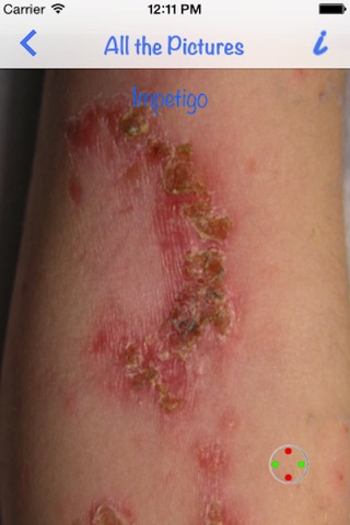 Dermatology by AIMapps screenshot 3