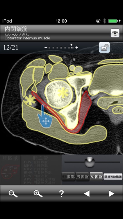 断面図ウォーカー女性骨盤CT無料版 screenshot-3