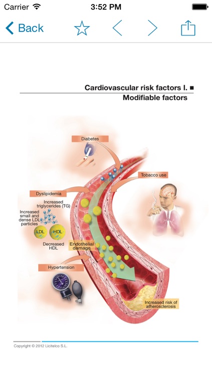 Miniatlas Acute Coronary Syndrome screenshot-3