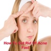 Acne: How To Get Rid Of Acne Fast!!