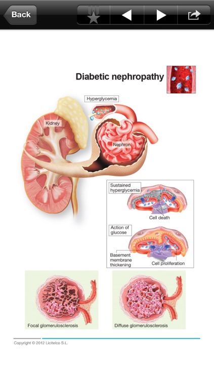 Miniatlas Diabetes Mellitus