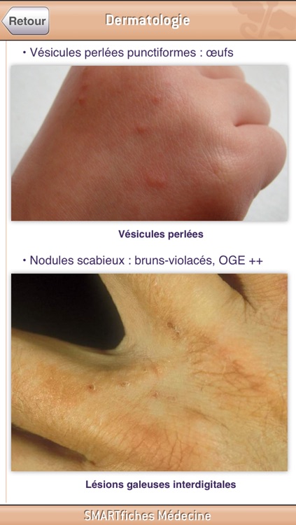 SMARTfiches Dermatologie Free screenshot-4