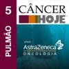 Separata Resumo Câncer Hoje - Pulmão 5