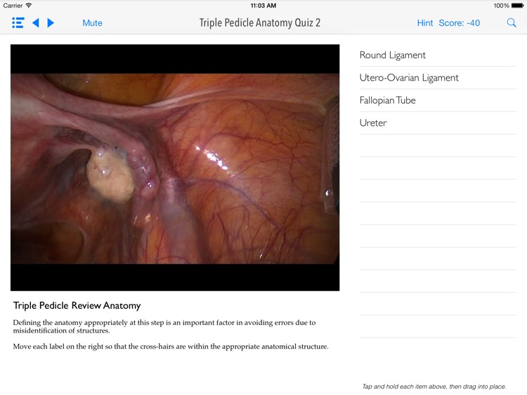 SimPraxis Lap Hysterectomy Trainer screenshot-4