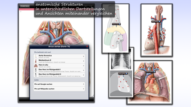 Thieme Anatomy on the Go 2.0 - English(圖3)-速報App