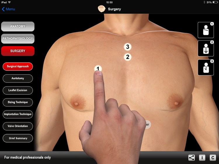 HEART MASTER Aortic Stenosis