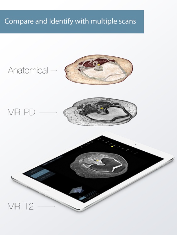 Radiology - Knee