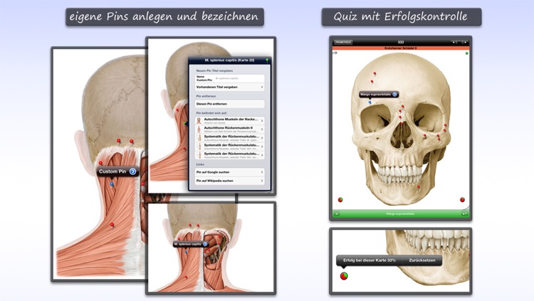 Thieme Anatomy on the Go 2.0 - English screenshot-3