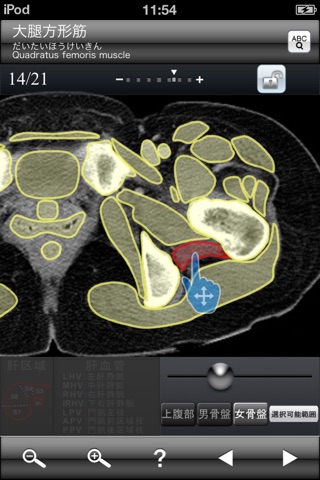 断面図ウォーカー女性骨盤CT無料版 screenshot 4