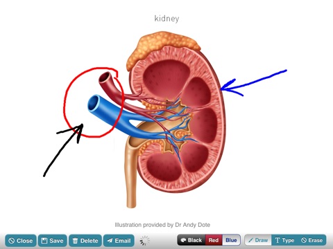 SurgiSketch screenshot 3