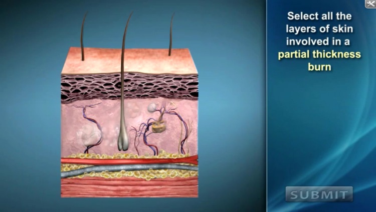 Medrills: Burns screenshot-4