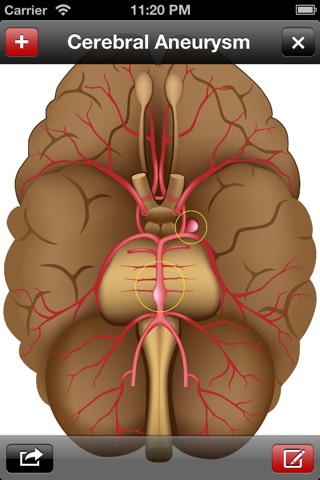 Med Sketch Lite: Anatomy Drawing App screenshot 2