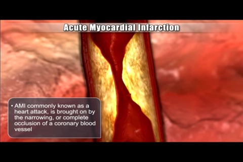 Medrills: Cardiac Emergencies screenshot 3