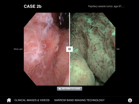 Urology NBI Atlas by Olympus screenshot 3