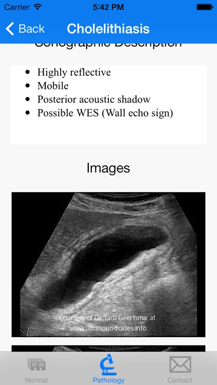 Ultrasound +