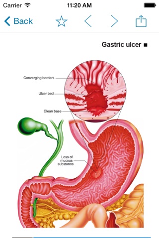 Miniatlas Gastroenterology screenshot 3