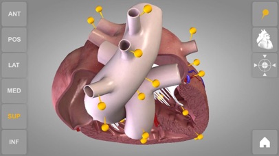 心臓解剖 Heart 3D Atlas of Anatomyのおすすめ画像5