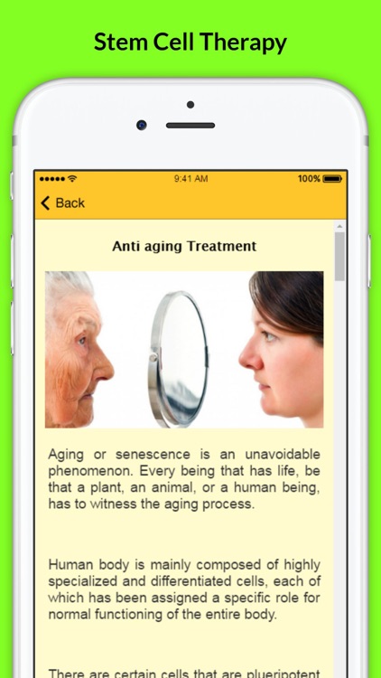 Stem Cell Therapy - Anti aging Treatment
