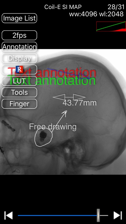 iMedViewer-Lite