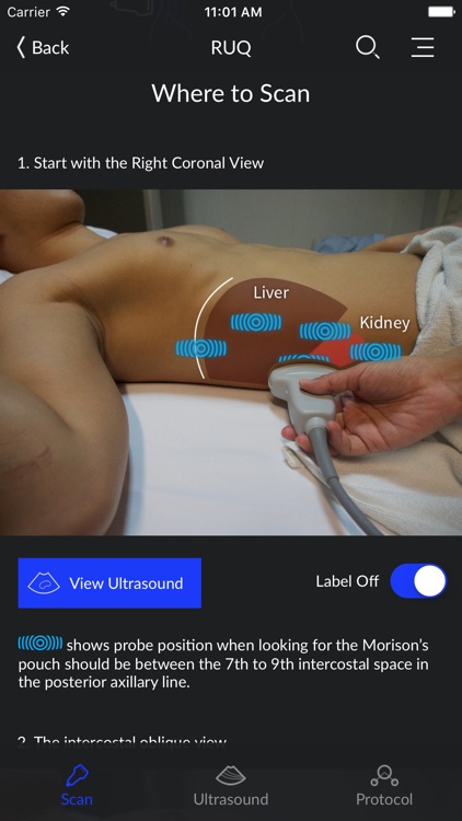 RESUS Ultrasound