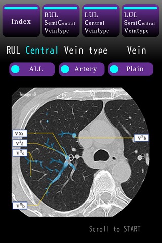LungCT Anatomy STUDY iP screenshot 3