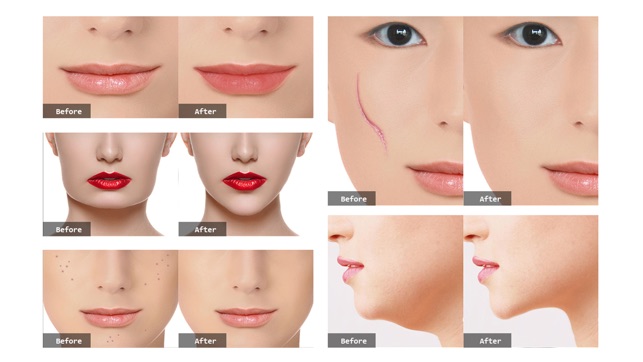 Photo Plastic Surgery Professional(圖4)-速報App