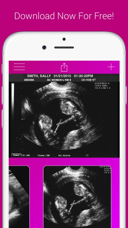 Ultrasound Prank Free - Pregnant Spoof And Fake Pregnancy Trick screenshot-3
