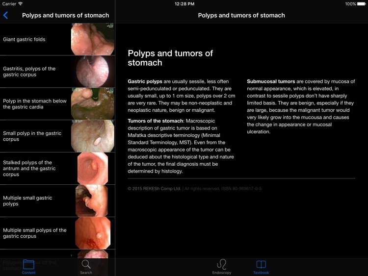 ENDO3®Atlas of GI Endoscopy HD screenshot-3
