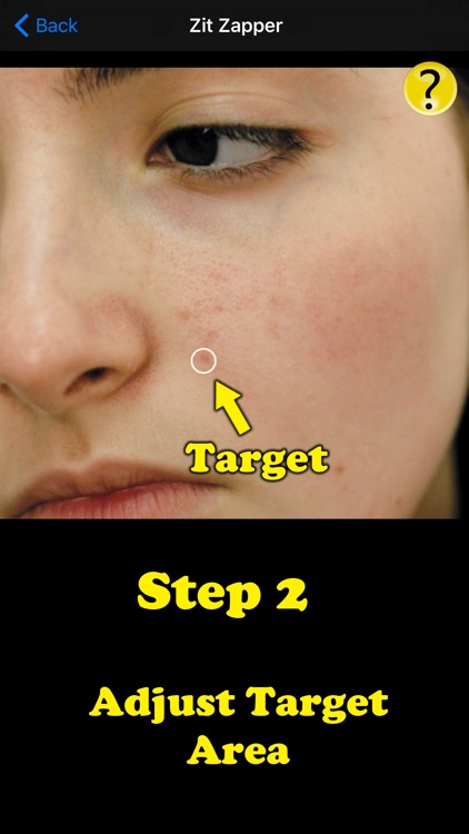 Zit Zapper Pro - Airbrush your face and remove pimples and acne