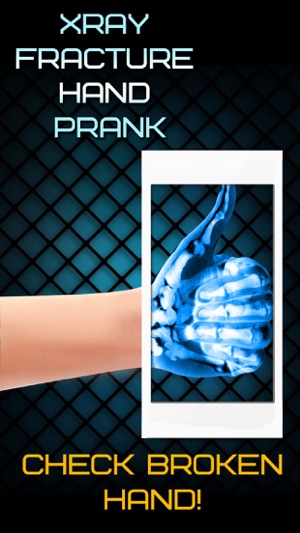 Xray Fracture Hand Prank(圖3)-速報App