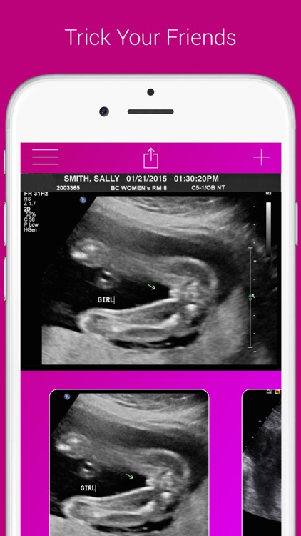 Ultrasound Prank Free - Pregnant Spoof And Fake Pregnancy Trick