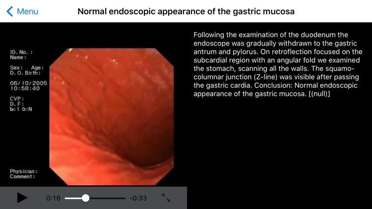 ENDO3® Atlas of Gastrointestinal Endoscopy - Lite screenshot-3