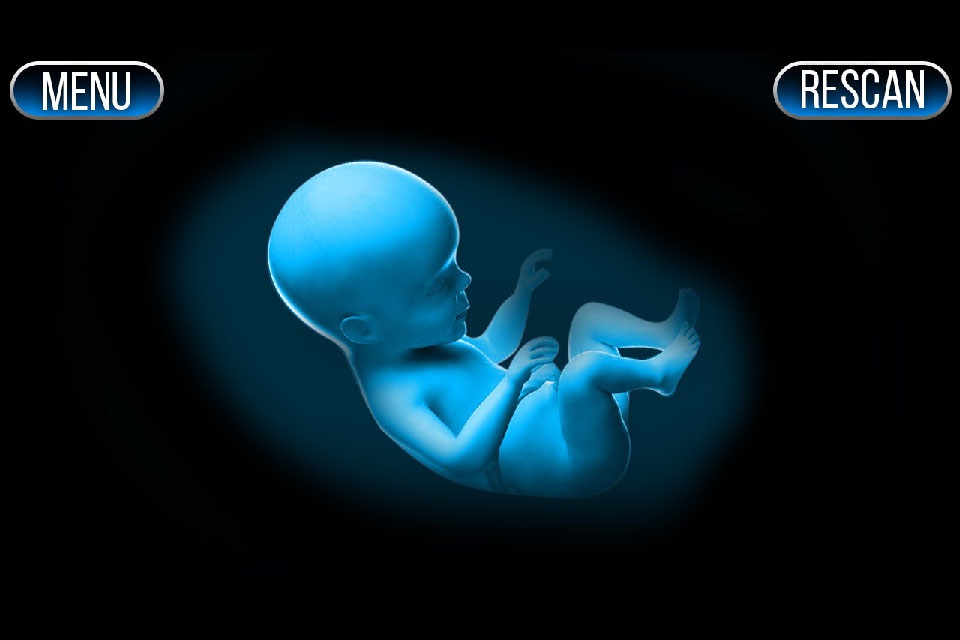 Xray Scanner Pregnant Prank screenshot 2