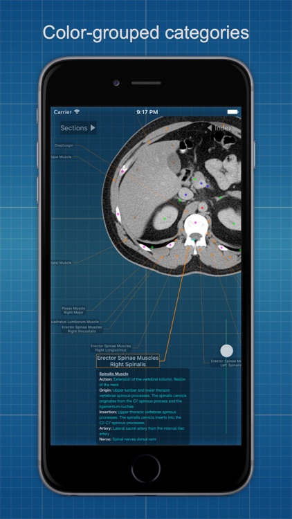 X-Anatomy Basic screenshot-4