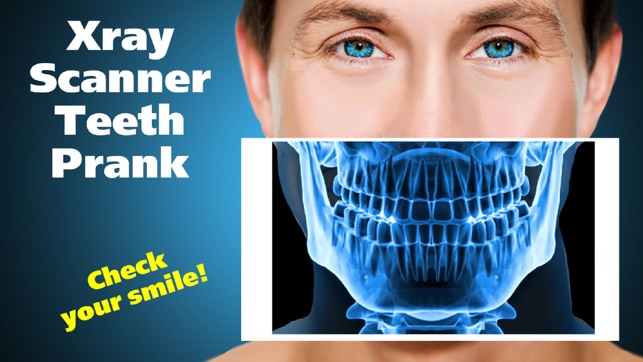 Xray Scanner Teeth Prank